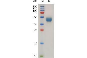 Human C Protein, hFc Tag on SDS-PAGE under reducing condition. (CXCR7 Protein (AA 1-40) (Fc Tag))