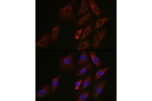 Immunofluorescence analysis of NIH/3T3 cells using SIRT3 Rabbit pAb (ABIN6134063, ABIN6147792, ABIN6147795 and ABIN6223143) at dilution of 1:50 (40x lens). (SIRT3 Antikörper  (C-Term))