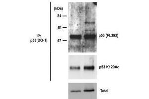 Western Blotting (WB) image for anti-Tumor Protein P53 (TP53) antibody (ABIN1449254) (p53 Antikörper)