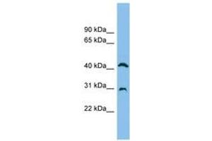Image no. 1 for anti-Adenosine Deaminase (ADA) (AA 71-120) antibody (ABIN6744916) (ADA Antikörper  (AA 71-120))
