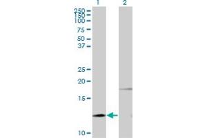 Western Blot analysis of PTH expression in transfected 293T cell line by PTH monoclonal antibody (M11), clone 3G9. (PTH Antikörper  (AA 32-115))