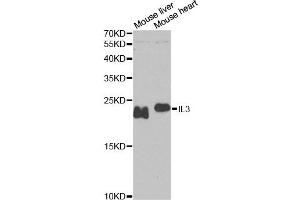 Western blot analysis of extracts of various cell lines, using IL3 antibody (ABIN1876872) at 1:1000 dilution. (IL-3 Antikörper)