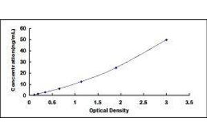 ELISA image for IgA Secretory Component ELISA Kit (ABIN481718) (IgA Secretory Component ELISA Kit)