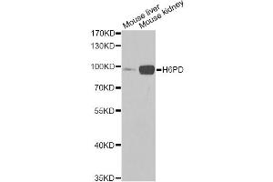 Western blot analysis of extracts of various cell lines, using H6PD Antibody (ABIN5973840) at 1/1000 dilution. (Glucose-6-Phosphate Dehydrogenase Antikörper)