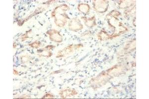 Immunohistochemistry of paraffin-embedded human kidney tissue using ABIN7170886 at dilution of 1:50 (SDHA Antikörper  (AA 44-664))