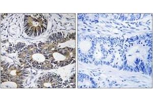 Immunohistochemistry (IHC) image for anti-Eukaryotic Translation Initiation Factor 1A, Y-Linked (EIF1AY) (AA 21-70) antibody (ABIN2890311) (EIF1AY Antikörper  (AA 21-70))