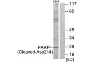 Western blot analysis of extracts from A549 cells, treated with etoposide 25uM 24h, using PARP (Cleaved-Asp214) Antibody. (PARP1 Antikörper  (Cleaved-Asp214))