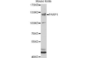 Western blot analysis of extracts of mouse testis, using PARP1 antibody (ABIN5995673) at 1/1000 dilution. (PARP1 Antikörper)