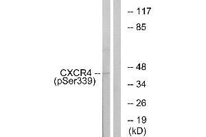 Immunohistochemistry analysis of paraffin-embedded human brain carcinoma tissue using CXCR4 (Phospho-Ser339) antibody. (CXCR4 Antikörper  (pSer339))