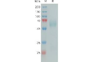 Human SAP Protein, His Tag on SDS-PAGE under reducing condition. (APCS Protein (AA 17-524) (His tag))