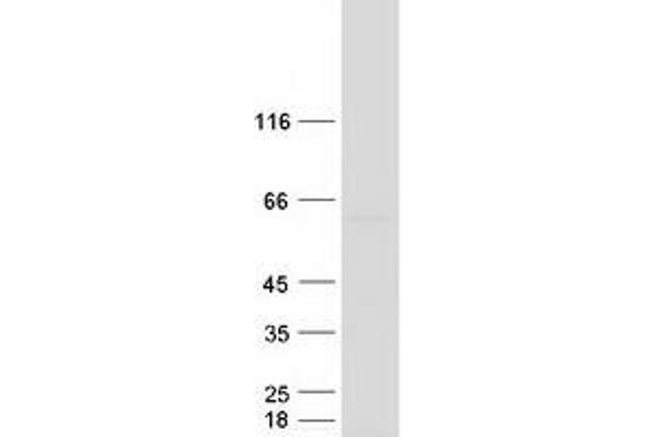 SNRNP70 Protein (Myc-DYKDDDDK Tag)