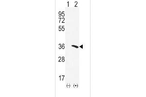 Western blot analysis of NAT2 using rabbit polyclonal NAT2 Antibody using 293 cell lysates (2 ug/lane) either nontransfected (Lane 1) or transiently transfected (Lane 2) with the NAT2 gene. (NAT2 Antikörper  (C-Term))