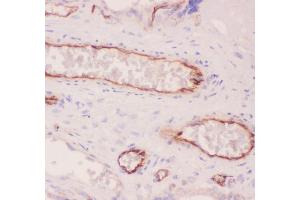 Anti-ACE Picoband antibody,  IHC(P): Human Placenta Tissue (Angiotensin I Converting Enzyme 1 Antikörper  (AA 651-864))