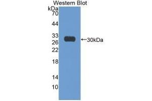 Detection of Recombinant Ki67P, Human using Monoclonal Antibody to Ki-67 Protein (Ki-67) (Ki-67 Antikörper  (AA 3088-3235))