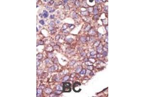 Immunohistochemistry (Paraffin-embedded Sections) (IHC (p)) image for anti-Synovial Apoptosis Inhibitor 1, Synoviolin (SYVN1) (AA 586-617), (C-Term) antibody (ABIN388980)