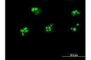 Immunofluorescence of purified MaxPab antibody to GNL3 on HeLa cell. (Nucleostemin Antikörper  (AA 1-549))