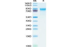 CADM1 Protein (AA 48-388) (His tag)