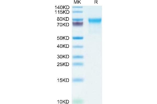 CADM1 Protein (AA 48-388) (His tag)