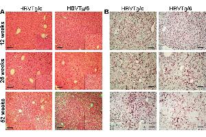 Paraffin-embedded sections of transgenic mice liver were stained with an antibody against HBsAg (ABIN285516). (HBSAg Antikörper)