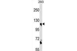 Western Blotting (WB) image for anti-Calsyntenin 1 (CLSTN1) antibody (ABIN3000590) (Calsyntenin 1 Antikörper)