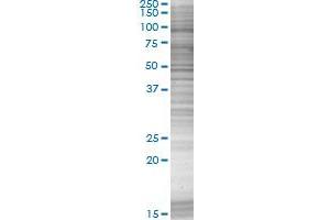 C2CD2L transfected lysate. (TMEM24 293T Cell Transient Overexpression Lysate(Denatured))