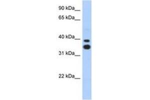 Image no. 1 for anti-Msh Momeobox 2 (Msx2) (N-Term) antibody (ABIN6742203) (Msx2/Hox8 Antikörper  (N-Term))