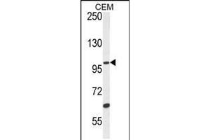 Western blot analysis in CEM cell line lysates (35ug/lane). (USP29 Antikörper  (AA 660-690))