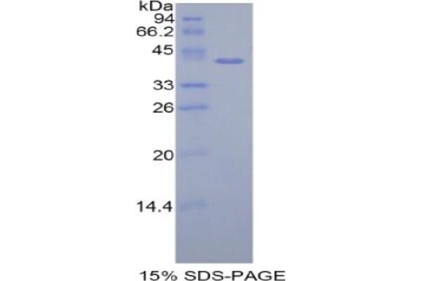 HIST1H2AH Protein