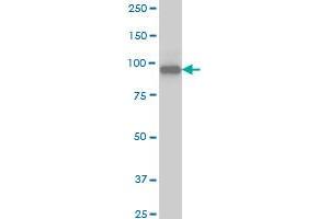 SRPK1 monoclonal antibody (M03), clone 6G9 Western Blot analysis of SRPK1 expression in Jurkat . (SRPK1 Antikörper  (AA 371-470))