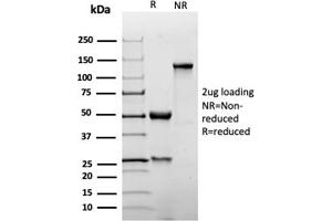 SDS-PAGE Analysis Purified p27 Recombinant Rabbit Monoclonal Antibody (KIP1/1355R). (Rekombinanter CDKN1B Antikörper)