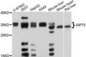 Western blot analysis of extracts of various cell lines, using SIRT5 antibody. (SIRT5 Antikörper)