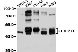 Western blot analysis of extracts of various cell lines, using TRDMT1 antibody (ABIN5999092) at 1/1000 dilution. (Dnmt2 Antikörper)