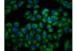 Immunofluorescence staining of Hela cells with ABIN7143334 at 1:133, counter-stained with DAPI. (ADCY6 Antikörper  (AA 9-118))