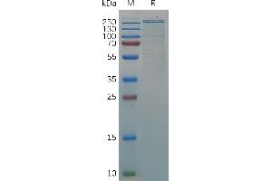 VWF Protein (AA 23-2813) (His tag)