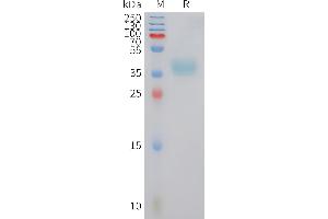 Human Protein, hFc Tag on SDS-PAGE under reducing condition. (XCR1 Protein (AA 1-31) (Fc Tag))