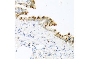 Immunohistochemistry of paraffin-embedded mouse lung using BMP4 antibody (ABIN5997308) at dilution of 1/100 (40x lens). (BMP4 Antikörper)