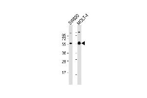 All lanes : Anti-RUNX1 Antibody  at 1:2000 dilution Lane 1: S whole cell lysate Lane 2: MOLT-4 whole cell lysate Lysates/proteins at 20 μg per lane. (RUNX1 Antikörper  (AA 227-255))