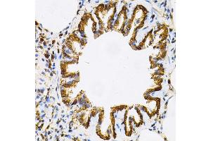Immunohistochemistry of paraffin-embedded rat lung using HSP90AB1 Antibody (ABIN5970445) at dilution of 1/100 (40x lens). (HSP90AB1 Antikörper)
