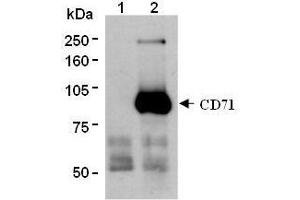 Western Blotting (WB) image for anti-Transferrin Receptor (p90, CD71) (TFRC) antibody (ABIN1449271) (Transferrin Receptor Antikörper)