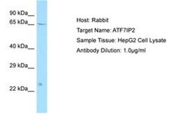 ATF7IP2 Antikörper  (AA 100-149)