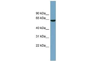 WB Suggested Anti-SLC5A8 Antibody Titration:  0. (SLC5A8 Antikörper  (Middle Region))
