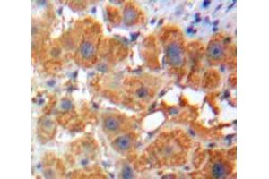 IHC-P analysis of Liver tissue, with DAB staining. (Apolipoprotein F Antikörper  (AA 111-314))