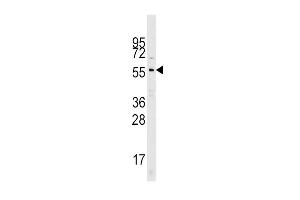 Western blot analysis of Cdc25A Pab (ABIN390213 and ABIN2840695) in mouse kidney tissue lysates (35 μg/lane). (CDC25A Antikörper  (N-Term))