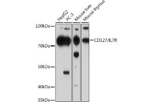 Western blot analysis of extracts of various cell lines, using CD127/IL7R Rabbit mAb (ABIN7268005) at 1:1000 dilution. (IL7R Antikörper)
