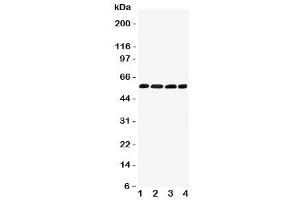 Western blot testing of IRF5 antibody and Lane 1:  human placenta (IRF5 Antikörper  (C-Term))