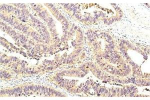 Immunohistochemistry of paraffin-embedded Human colon tissue using STAT1 Monoclonal Antibody at dilution of 1:200. (STAT1 Antikörper)