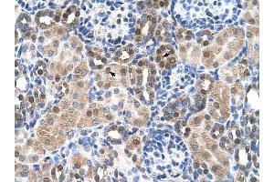 SLC46A3 antibody was used for immunohistochemistry at a concentration of 4-8 ug/ml to stain Epithelial cells of renal tubule (arrows) in Human Kidney. (SLC46A3 Antikörper  (N-Term))