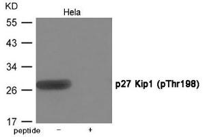 Western blot analysis of extracts from Hela cells using p27 Kip1 (Phospho-Thr198) Antibody. (CDKN1B Antikörper  (pThr198))
