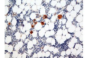 Immunohistochemistry (IHC) image for anti-Integrin Alpha2b (CD41) antibody (ABIN108423) (Integrin Alpha2b Antikörper)