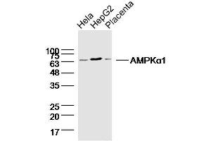 Lane1: HeLa lysates Lane 2: HepG2 lysates Lane 3: mouse placenta lysates probed with AMPK alpha-1 Polyclonal Antibody, Unconjugated  at 1:300 dilution and 4˚C overnight incubation. (PRKAA1 Antikörper)